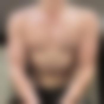 MA17