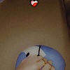 barefootabortion