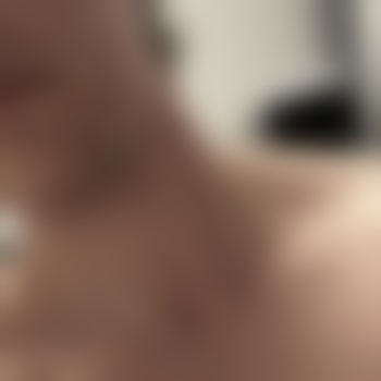 VAC288