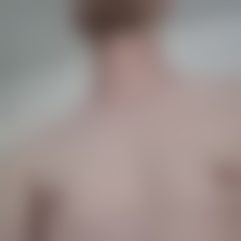 Cuckyoung11