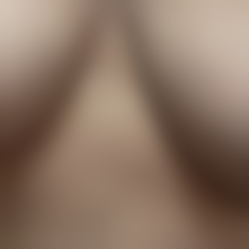 pokygilf