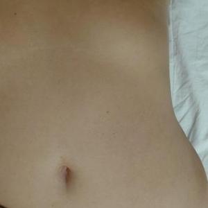 Stini1