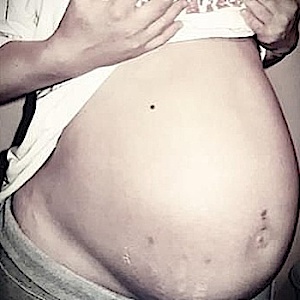 Pregoembarazada