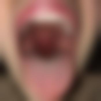 Nutzloch99