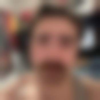 addi420