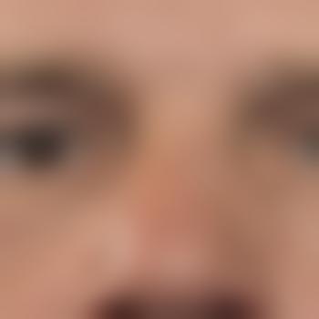 kittenhealertobeg
