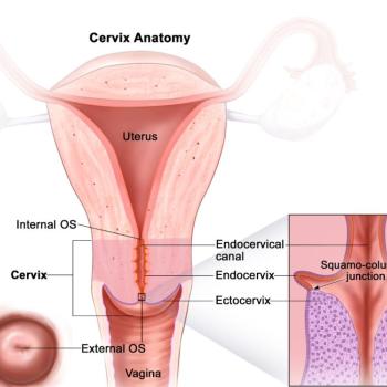 Uterus-Cervix-Doktor