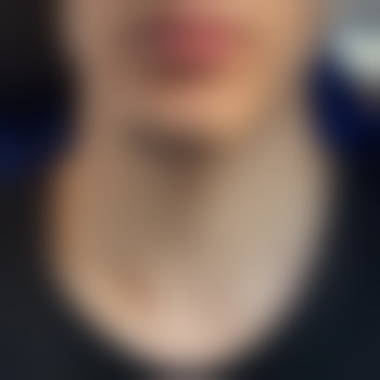 Mer2o